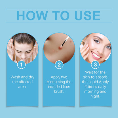 Keyu Liquid Hand And Foot Skin Especially Moles Cleansing Repair Smooth Skin Skin Label Care Liquid