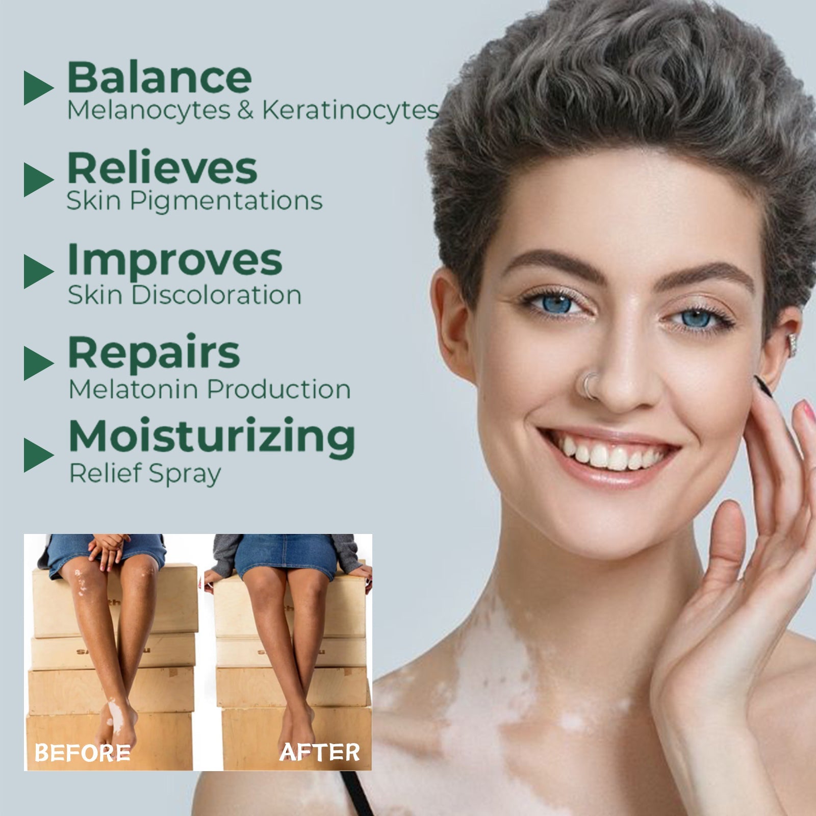 Vitiligo Relief Cream, Repair White Spots Flower Spots Skin Topical Care Ointment