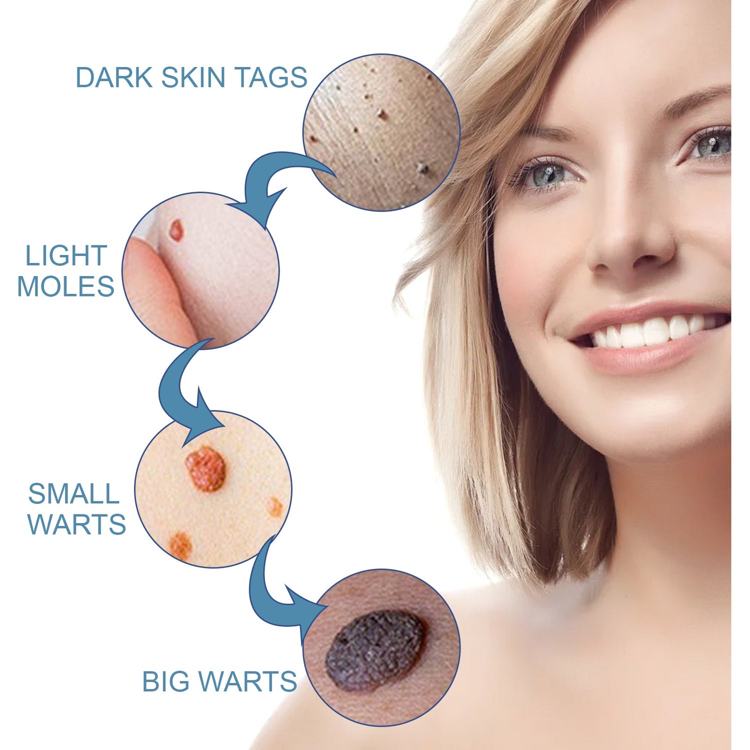 Wart Cream, Skin Clean And Smooth Wart Nevi Facial Care Cream