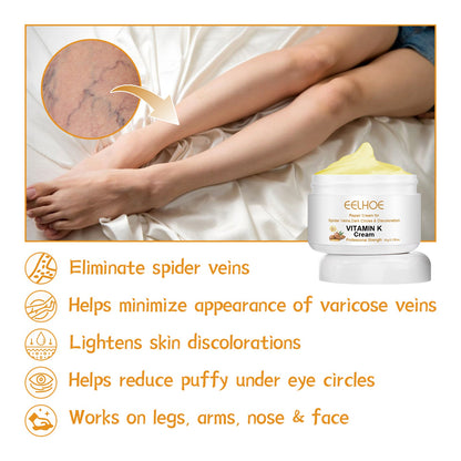 Vitamin K Varicose Vein Leg Cream