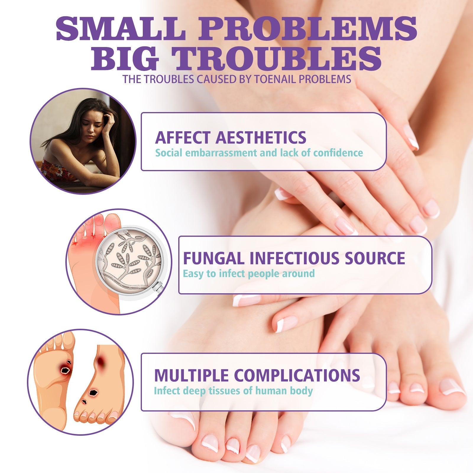 Gray Nail Care Spray Soft Ingrown Nails, Ingrown Nails, Yellowing And Thickening Cleaning Care