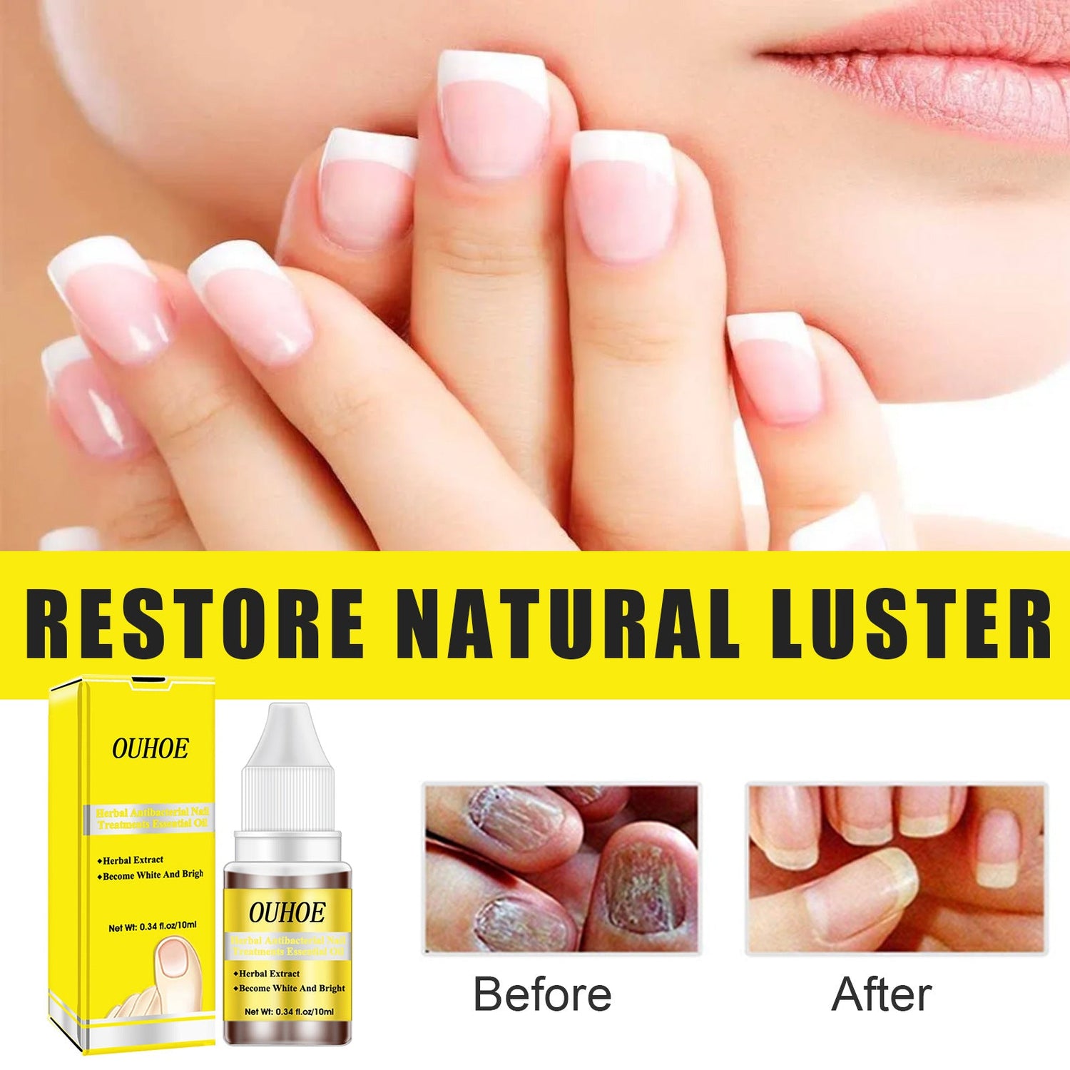 Herbal Antibacterial Nail Treatments Essential Oil, Grey Nail Care Essential Oil Brightening Nail Polish Clean Manicure Foot Care Solution