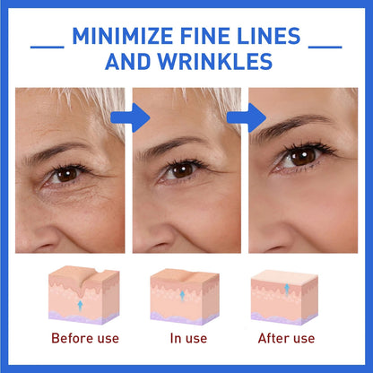 Anti-Aging Collagen Serum with Nicotinamide, Vitamin C, Hyaluronic Acid - Reduce Dark Spots, Cleanse &amp; Tighten Skin