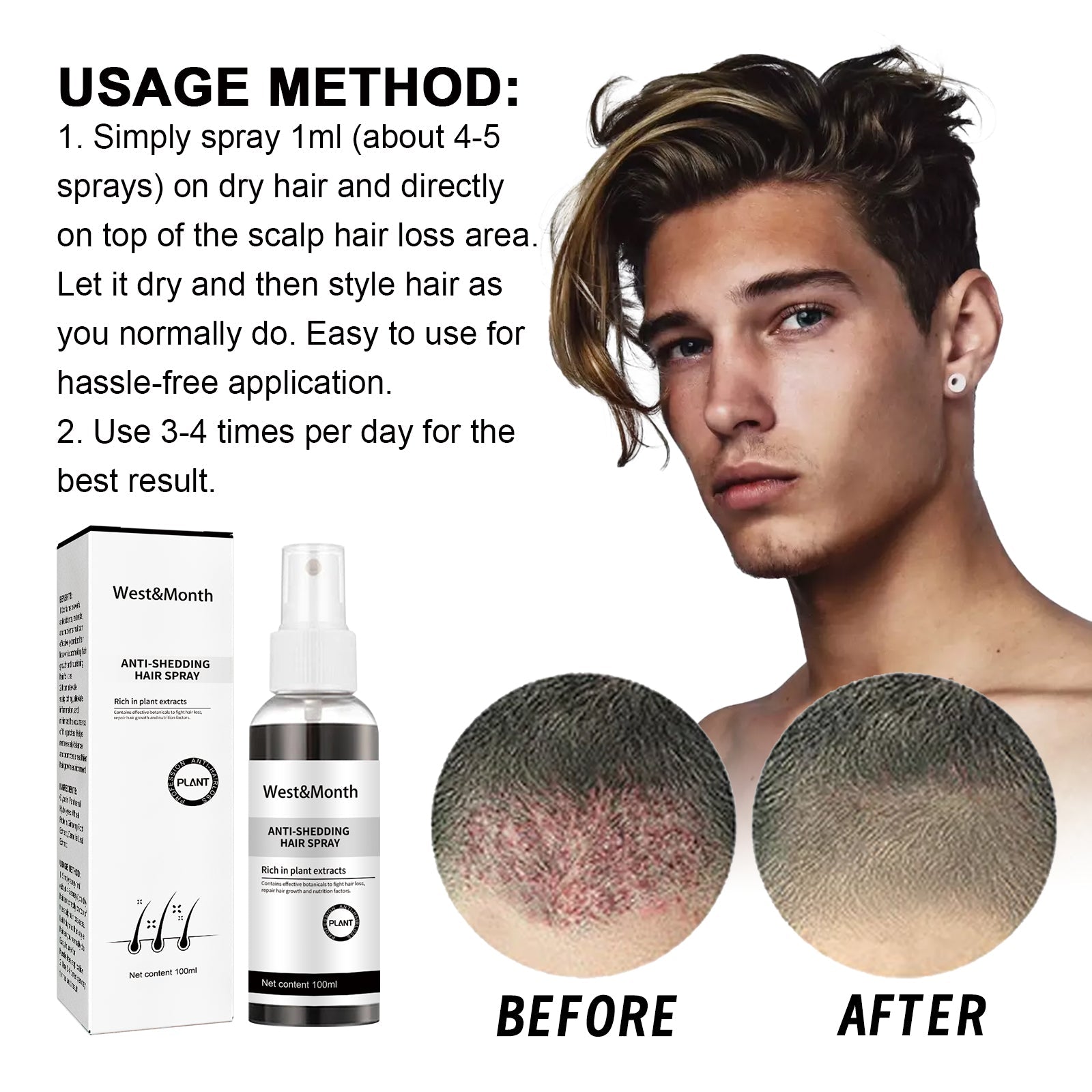 West &amp; Month Anti-Shedding Hair Spray, Improve The Hairline Hair Hair Nutrition Moisture Hair Roots