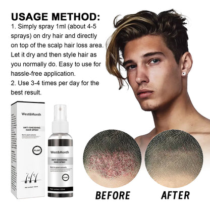 West &amp; Month Anti-Shedding Hair Spray, Improve The Hairline Hair Hair Nutrition Moisture Hair Roots