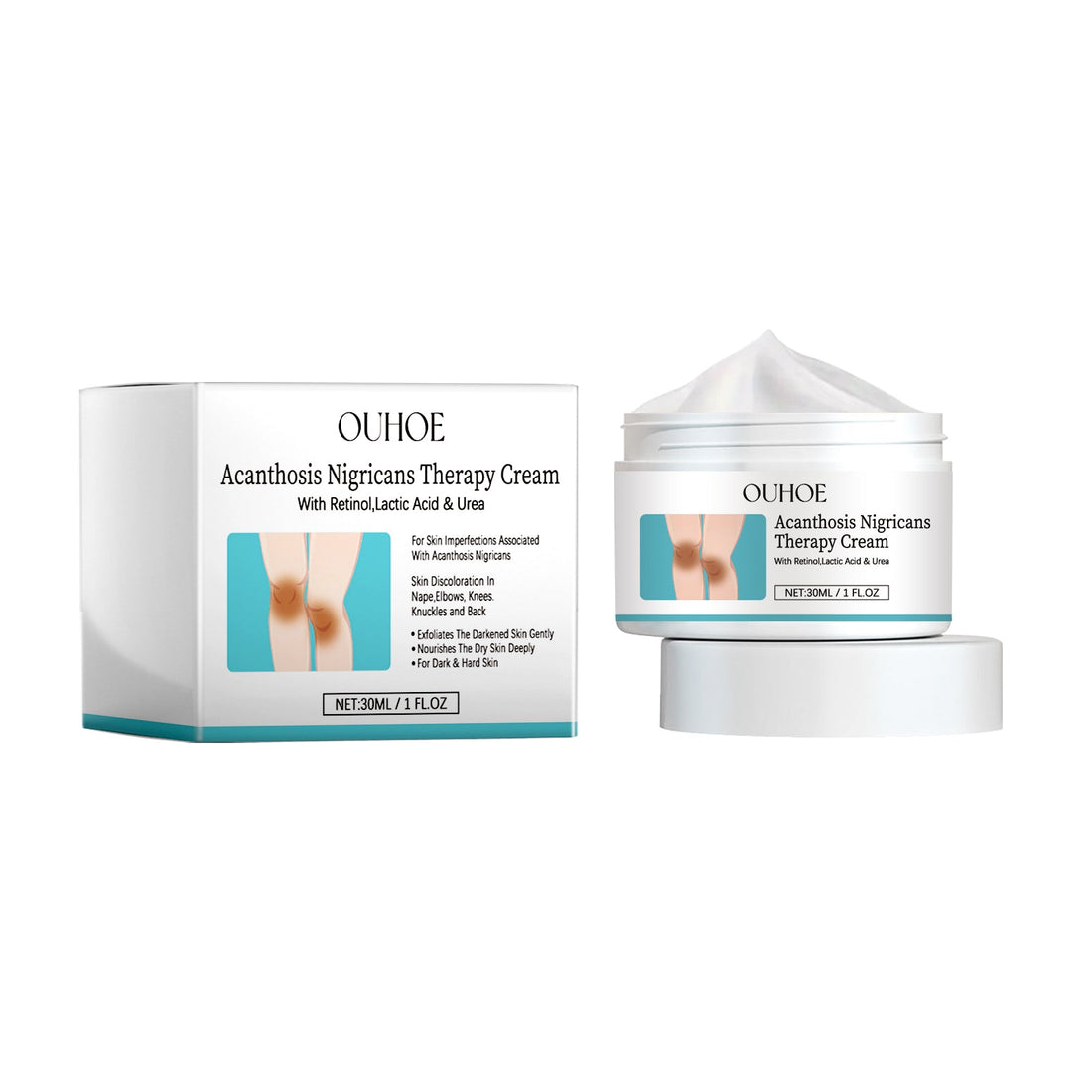Acanthosis Nigricans Therapy Cream, Repair Dull Skin Lightening Joint Black Moisturizing Whitening Skin Care Cream
