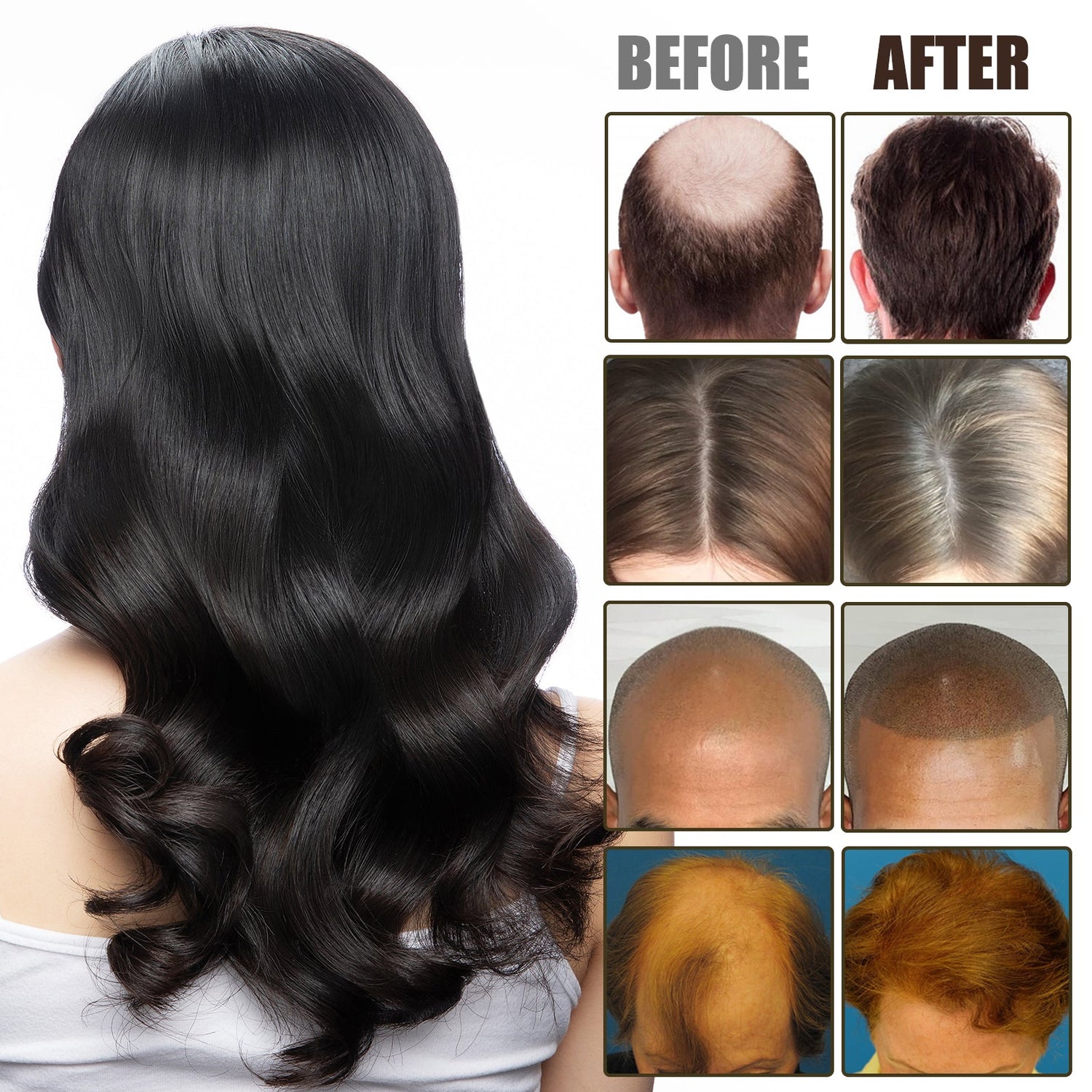NMN Scalp Cell Revitalizing Hair Essence, Hair Care Strengthen And Strengthen Hair Repair Hair Root Thickening Hair Moisturizing Essence