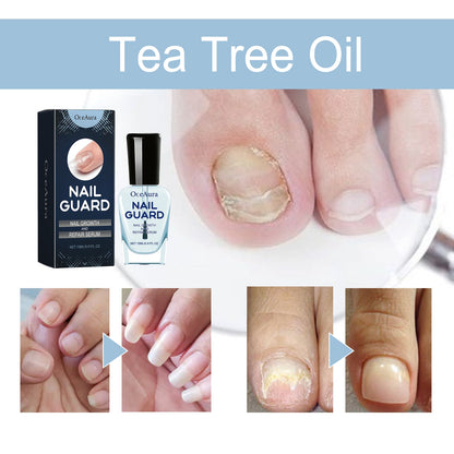 OCEAURA Nail Repair Lotion, Foot And Nail Nourishing Repair Soft Nails Gentle Clean Bright Nails Care