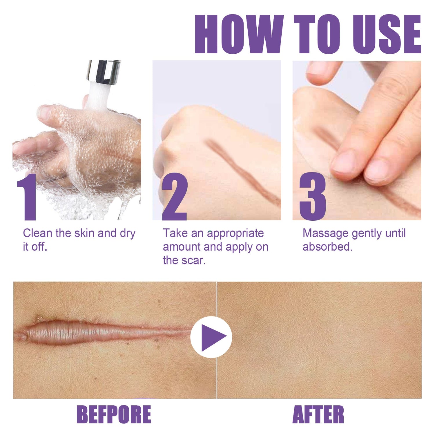 Skin Care Cream, Daily Moisturizing, Smoothing And Firming Skin Repair Postpartum Repair Topical Cream