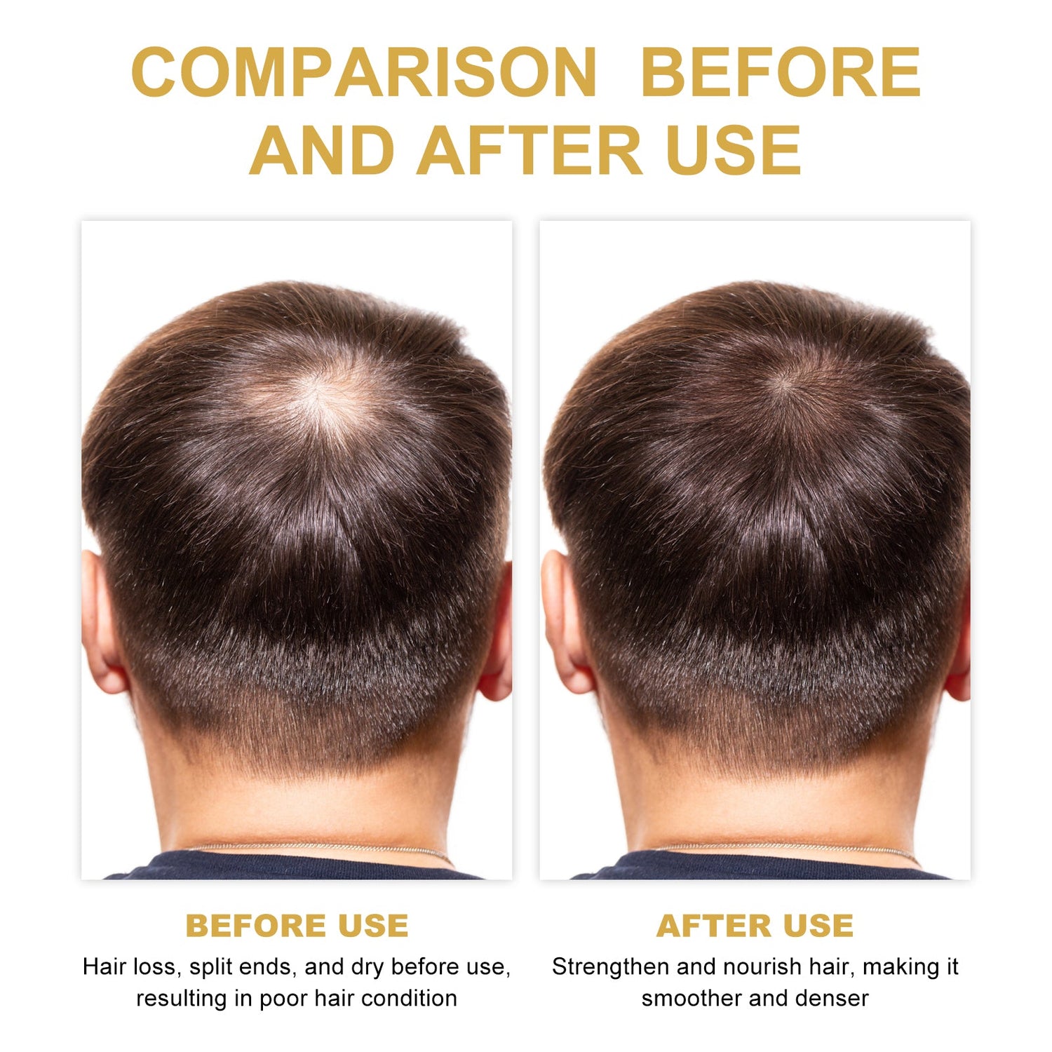 Hair Dense Oil, Scalp Cleaning Care Fluffy Soft Repair Dry Hair Impetuous Solid Hair Dense Hair Essential Oil