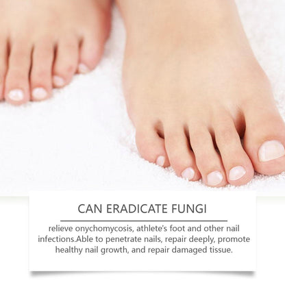 Nail Care Solution Moisturizes Nails, Soft Nails, Thick Nails And Nails, Neat And Glossy Daily Care Solution