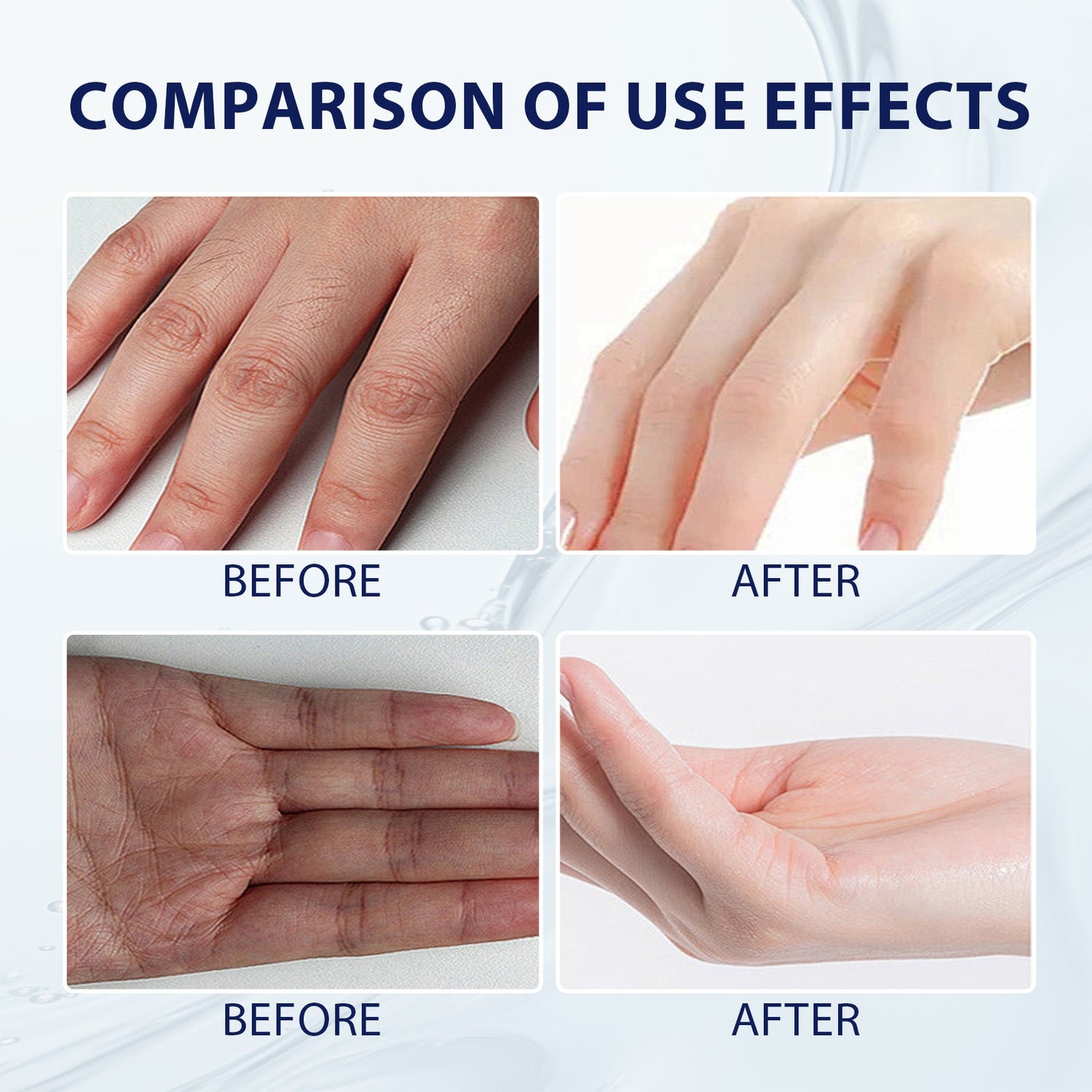Aloe Vera Care Gel, Hydrating And Refreshing Moisturizing Cream Prevents Dryness And Cracks To Repair Hand Skin