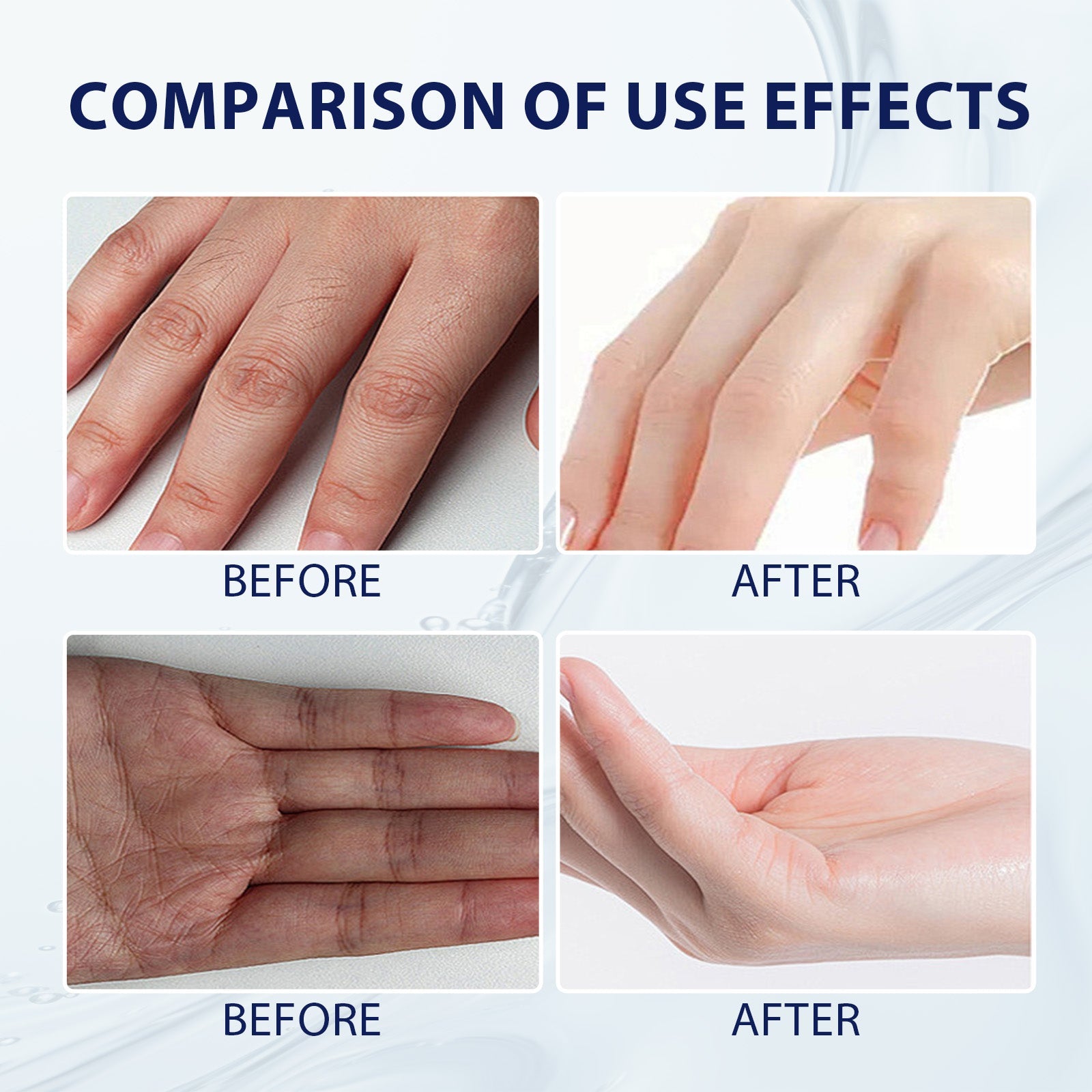 Aloe Vera Care Gel, Hydrating And Refreshing Moisturizing Cream Prevents Dryness And Cracks To Repair Hand Skin