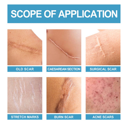 Scar Repair Serum Lightens Post-Pregnancy Scar Repair And Smoothes Body Skin
