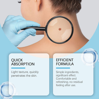 Keyu Liquid Hand And Foot Skin Especially Moles Cleansing Repair Smooth Skin Skin Label Care Liquid