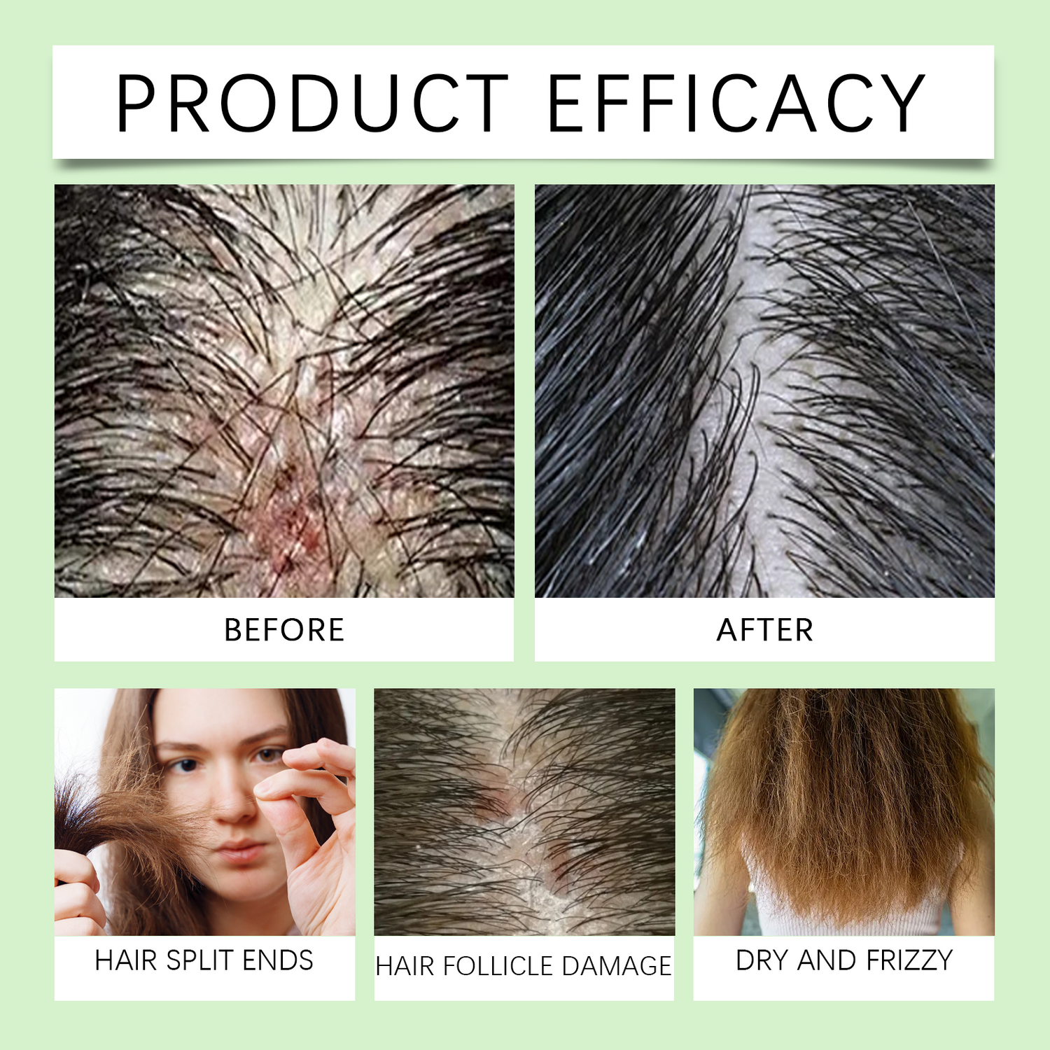 Hair Care Conditioner Scalp Root Care Care Nourishes Hair Follicles Hair Shine Conditioner