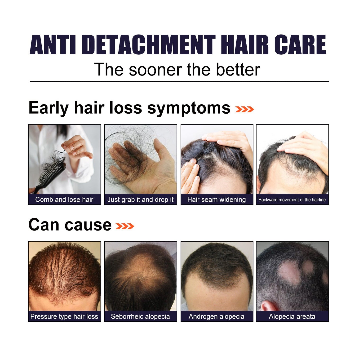 Herbal Hair Essence, Moisturizes Scalp Strong Hair Roots Thick Beard Care Essence