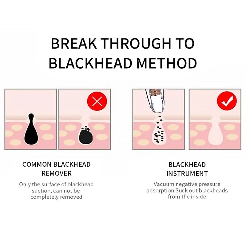Diamond Blackhead Vacuum Remover
