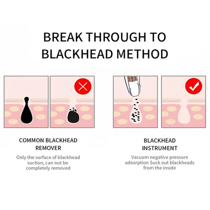 Diamond Blackhead Vacuum Remover